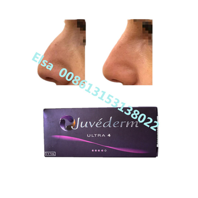 Juvederm Sodium Ultra4 Voluma Dermal Filler para aumento do lábio e do queixo