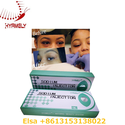 1 ml de gel de hialuronato de sódio anti olheiras preenchimento dérmico para os olhos