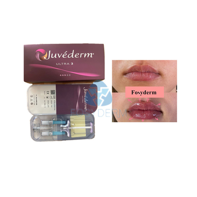 Preenchimento dérmico de ácido hialurônico Voluma Fosyderm para aumentar os lábios
