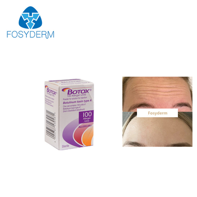 100Units Allergan Toxion Botulinum para removem o tipo facial A de Botox dos enrugamentos