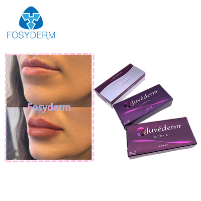 Lips Enhance Dermal Filler 2*1ml Juvederm Injeção de Ácido Hialurónico