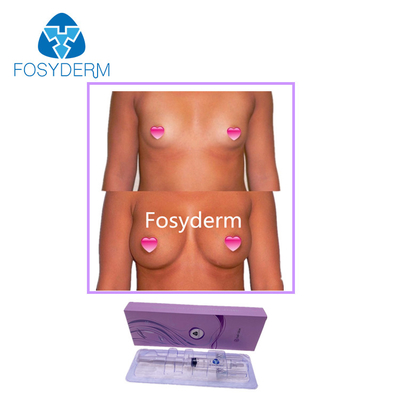 Enchimentos cutâneos nádega do ácido hialurónico de Fosyderm 10ml e injeção da ampliação do peito