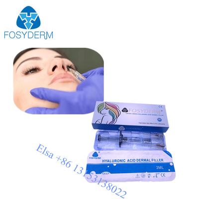 Enchimento cutâneo ácido injetável de Fosyderm Hyaluornic com enchimentos da cara do nariz do bordo do lidociane 2ml