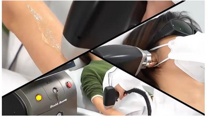 Poderoso Novo Diodo de Gelo de 808nm Trio 3 Ondas Diodo Laser 810nm Depilação 808 Nm depilação 3 Ondas Titânio Medical Machi 2