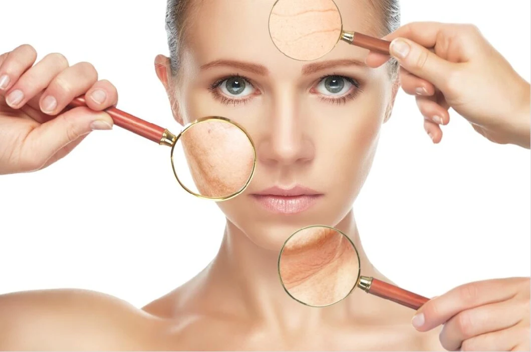 Hyamely Ácido Hialurónico Meso Solução Dermal Filler Serum de mesoterapia para cuidados com a pele 0