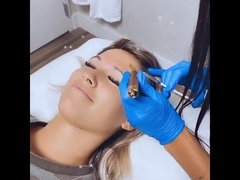 Injeção de Botox