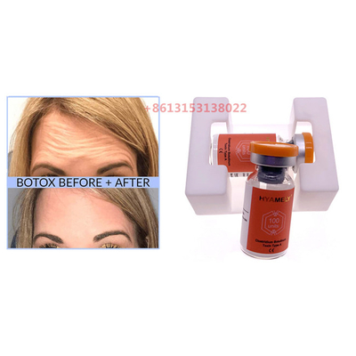 Da injeção Botulinum do pó de Botulax da toxina do  de Hyamely anti enrugamentos