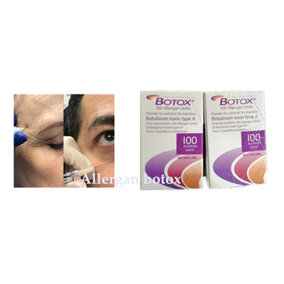 A injeção Botulinum de Allergan  da toxina para o enrugamento remove