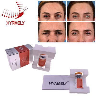 Injeção Botulinum da toxina de Hyamely  dos materiais de Coreia para enrugamentos faciais