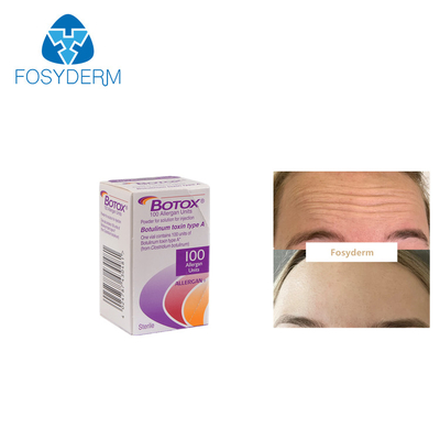 100Units Allergan Toxion Botulinum para removem o tipo facial A de  dos enrugamentos