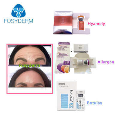 100 unidades datilografam a uma toxina Botulinum Allergan a anti injeção facial de  Botulax dos enrugamentos