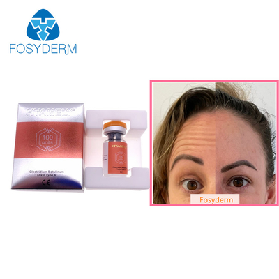 100 unidades datilografam a uma toxina Botulinum Allergan a anti injeção facial de  Botulax dos enrugamentos