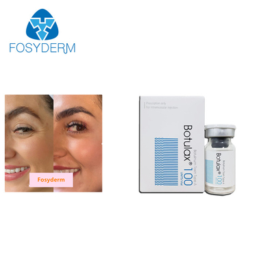 da injeção Botulinum da toxina de 100units TypeA anti enrugamentos  Allergan