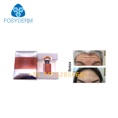 da injeção Botulinum da toxina de 100units TypeA anti enrugamentos  Allergan