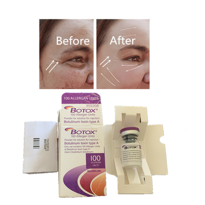 Injeção Botulinum da toxina de Allergan  para os anti enrugamentos antienvelhecimento