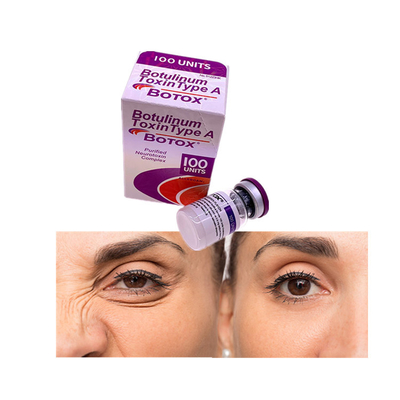 Removendo as linhas faciais unidades Botulinum Allergan o da toxina 100
