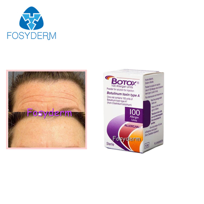 100 unidades Toxina Botulínica Alérgico Remover Rugas Faciais Injecção  Tipo A