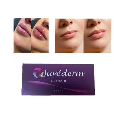 Juvederm Ácido Hialurónico Preenchimento Dermológico Anti- Rugas Preenchimento Facial de Lábios
