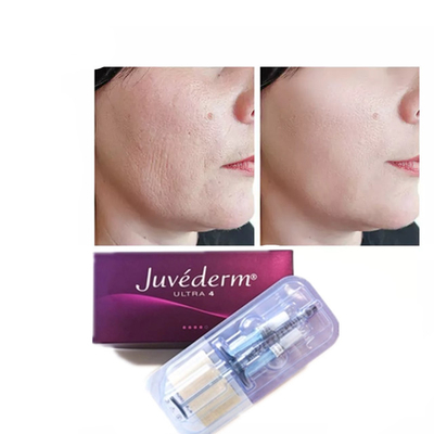 Juvederm Hyaluronic Acid Anti- Aging 2*1ml Filler Facial