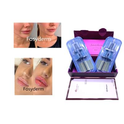 Juvederm Hyaluronic Acid Anti- Aging 2*1ml Filler Facial