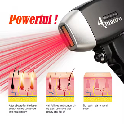 Máquina de remoção de pelos a laser inteligente para todos os tipos de pele com tela 4K