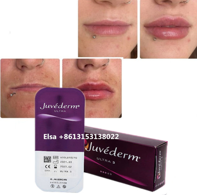 Cosméticos Cuidados da Pele Injecções Plumper de Lábios Juvederm Filler Injeção Para Nariz Chin Lip