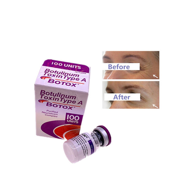 Insolúvel em água Allergan 100 Unidades Toxina Botulínica Perfeita para Fabricação