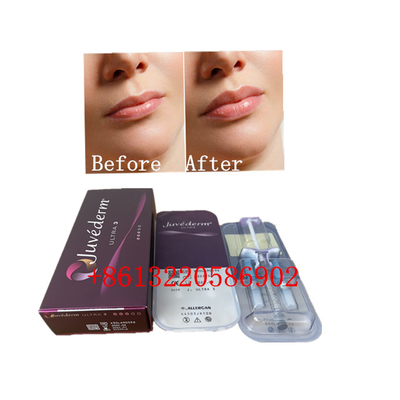 Rejuvenescimento facial com tratamento de preenchimento cutâneo sem efeitos colaterais