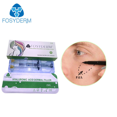 Fosyderm Deep 2ml Filler Dermal para Rejuvenescimento Facial HA Filler