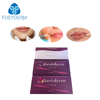 Combinado com Ácido Hialurónico Juvederm Ultra 2 3 4