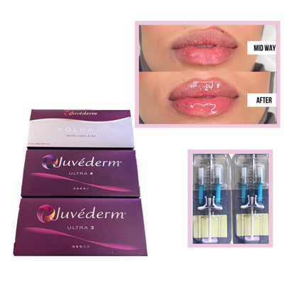 Juvederm Voluma Ultra3 Ultra4 HA Gel de Enchimento 2 ml Ácido Hialurónico