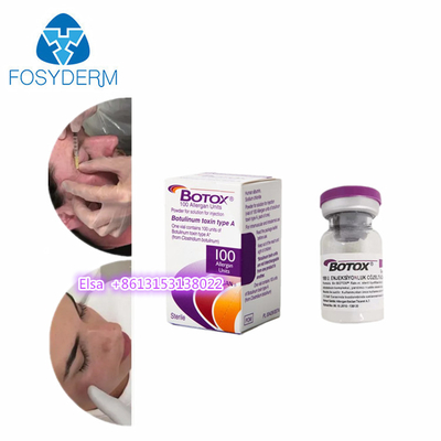 Allergan  Toxina Botulínica 100IU  Injeção Dysport 500 anti- rugas