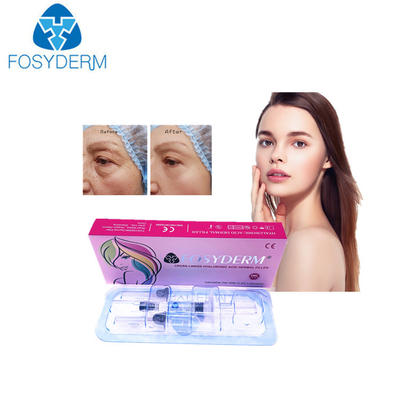 OEM Hyaluronic Acid Dermal Filler para pele grossa e radiante
