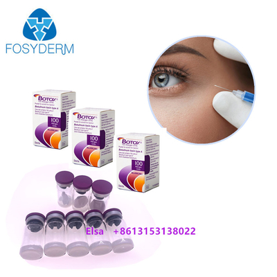 100 IU de Toxina Botulínica Injecção Eliminação de Rugas Allergan Dysport Botulax