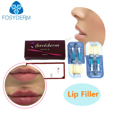 2 ml de enchimento cutâneo com ácido hialurónico JUVEDERM Gel injetável para enchimento de rugas