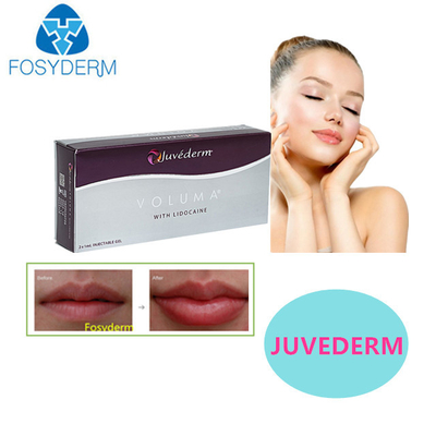 Juvederm Hyaluronic Acid Filler Derm Sexy Lips 24mg Para Enchimento Facial