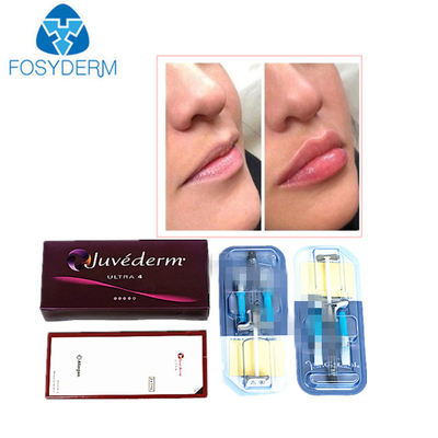 Juvederm Ácido Hialurónico Preenchimento Dermológico Anti- Rugas Injecção Para Rosto