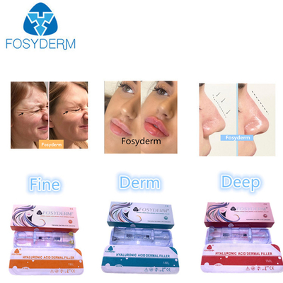Hyaluronic Acid Dermal Filler 1 ml-50 ml para Rosto e Corpo