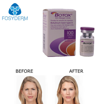 Injecção Allergan Botox 100 unidades para remoção de rugas