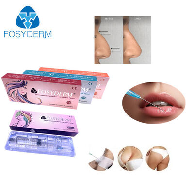 Cross-linked Hyaluronic Acid Injection Gel Facial Dermal Filler