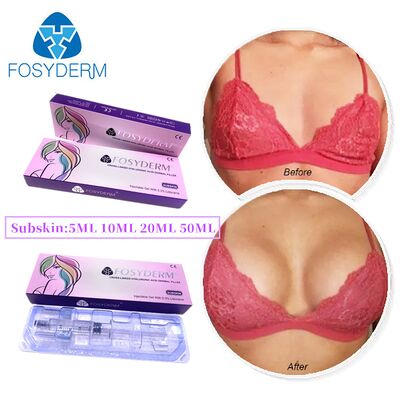 Fosyderm Cross-Linked Hyaluronic Acid Dermal Filler para Cirurgia Plástica