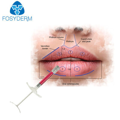 Most Popular 1ml Red Lips Filler Hyaluronic Acid Injectable Dermal Filler