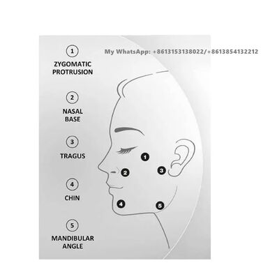 Profhilo 64 mg/2 ml Ácido hialurónico Injecção de preenchimento cutâneo Cuidado da pele