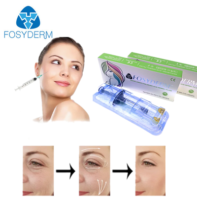 Preenchimento Dérmico HA para Rejuvenescimento Facial para Rosto, Queixo, Bochechas, Lábios, Corpo, Bumbum