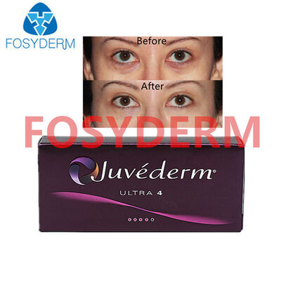 Preenchedor Dérmico de Ácido Hialurônico Juvederm para Lábios e Levantamento Facial 24mg
