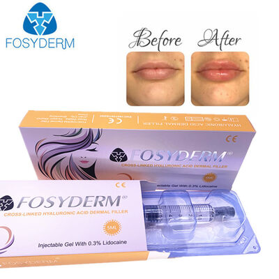 Hyaluronic Acid Dermal Filler Anti- Rugas Facial Lifting 1 ml 2 ml