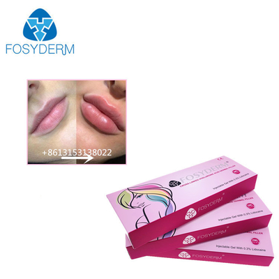 Fosyderm 1 ml Ácido Hialurónico Injecções de Enchimento Dermológico Para Aumentar o Tamanho dos Lábios