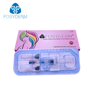 O enchimento dos bordos de Fosyderm 2Ml que remove o meio enruga o ácido hialurónico