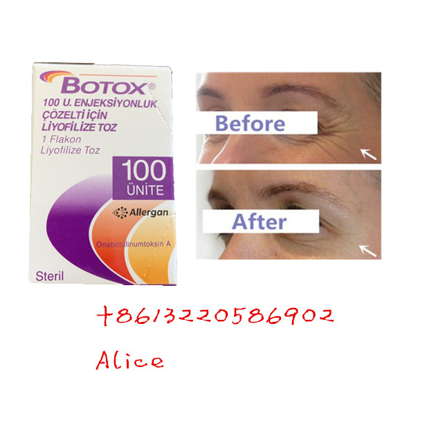A toxina Botulinum Allergan do anti enrugamento antienvelhecimento datilografa um pó de