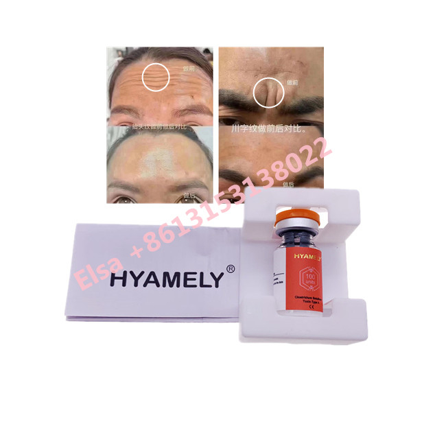 Toxina Botulinum de Hyamely  para datilografar um cosmético coreano de  100u